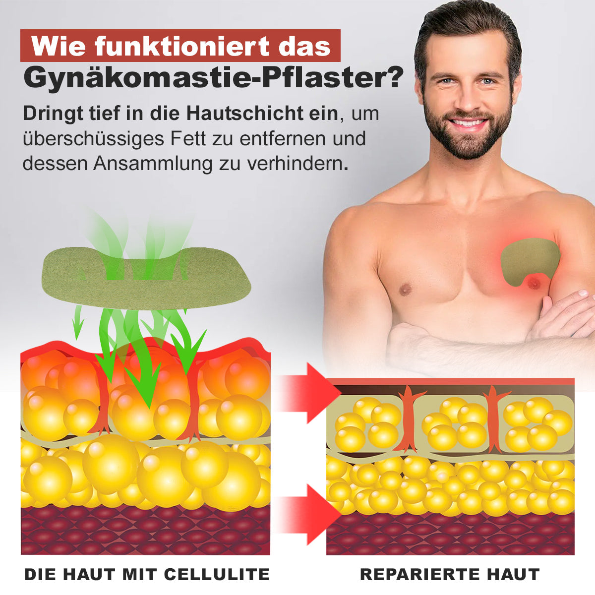 Luhaka™ 🌟Gynäkomastie Cellulite-Schmelzpflaster🌟